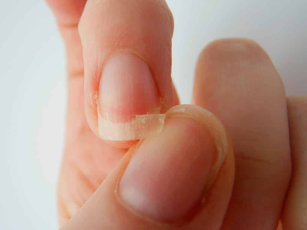 6 dicas indispensáveis para ter unhas fortes, saudáveis e bonitas.