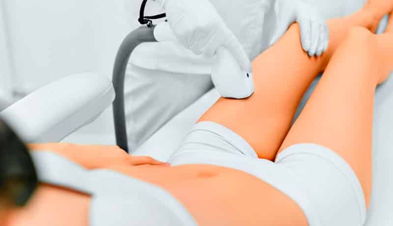 Tudo sobre a depilação a laser diodo