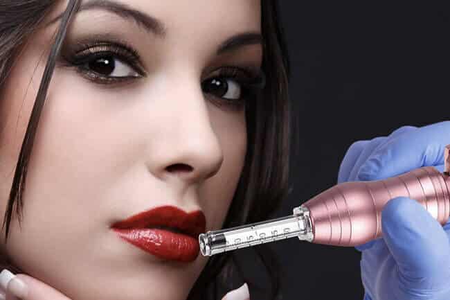 Tudo que precisa saber sobre a Hyaluron Pen