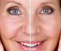 Tratamentos de Rosto e Corpo Avançados - Byas Facelifter